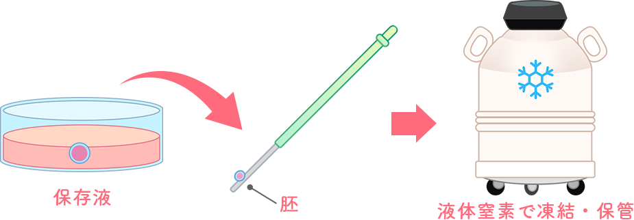 凍結保存の方法 イメージ