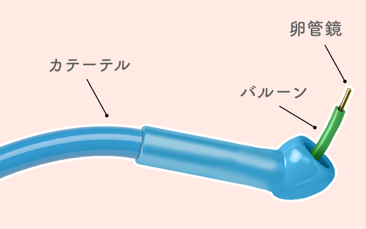 卵管通気検査、卵管通水検査